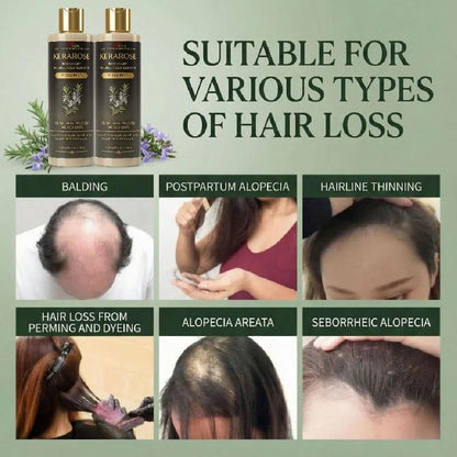 Rosemary Keratin Shampoo (Pack of 2)